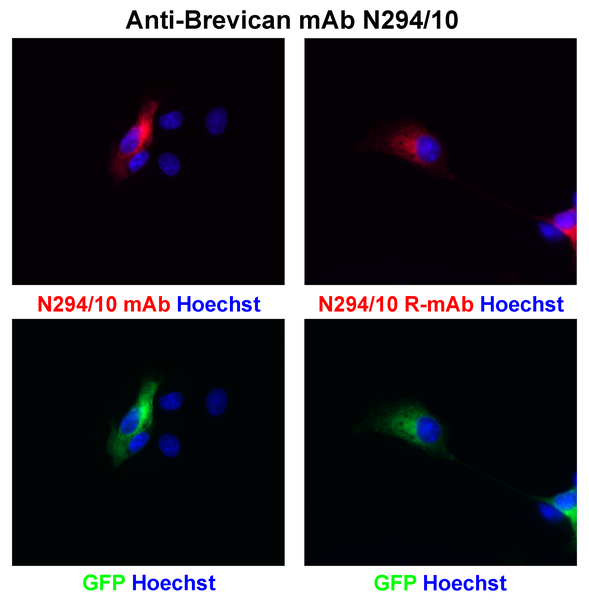 Addgene: Fluorescence Titering Assay – WPWT