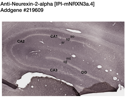 Immunohistochemistry image by NIH NeuroMab