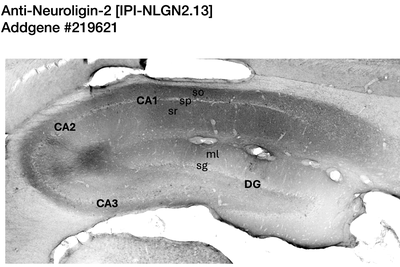 Immunohistochemistry image by NIH NeuroMab