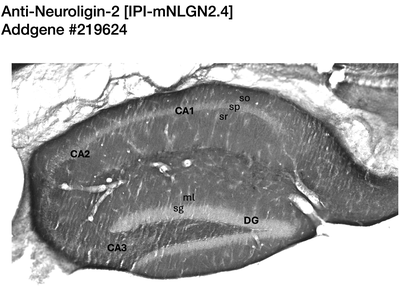 Immunohistochemistry image by NIH NeuroMab