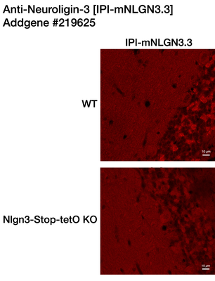 Immunohistochemistry image by Peter Scheiffele, PhD