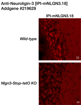 Immunohistochemistry image by Peter Scheiffele, PhD