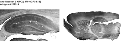 Immunohistochemistry image by James Trimmer, UC Davis