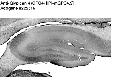 Immunohistochemistry image by James Trimmer, UC Davis