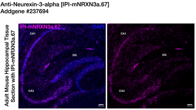 Immunohistochemistry image by Institute for Protein Innovation (IPI)