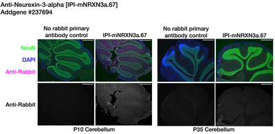 Immunohistochemistry image by Institute for Protein Innovation (IPI)