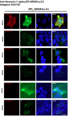 Immunocytochemistry image by Luís F. Ribeiro, PhD