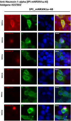 Immunocytochemistry image by Luís F. Ribeiro, PhD
