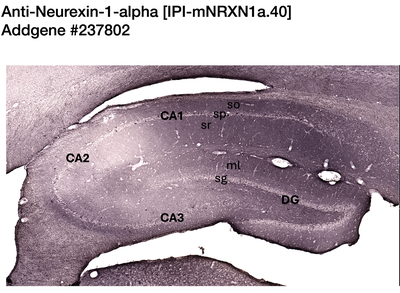 Immunohistochemistry image by NIH NeuroMab