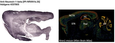 Immunohistochemistry image by NIH/NeuroMab