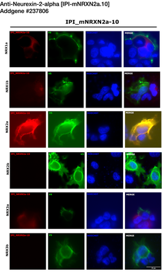 Immunocytochemistry image by Luís F. Ribeiro, PhD