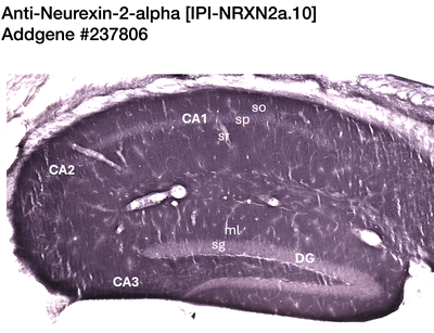 Immunohistochemistry image by NIH NeuroMab