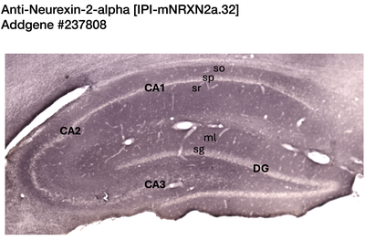 Immunohistochemistry image by NIH NeuroMab