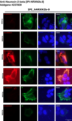 Immunocytochemistry image by Luís F. Ribeiro, PhD