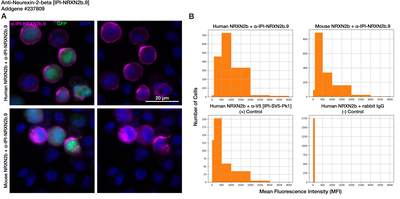 Immunocytochemistry image by Institute for Protein Innovation (IPI)