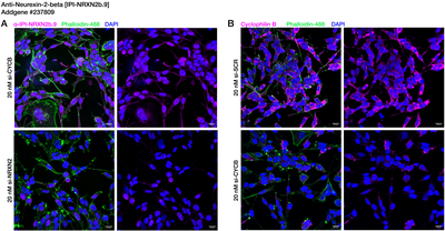 Immunocytochemistry image by Institute for Protein Innovation (IPI)