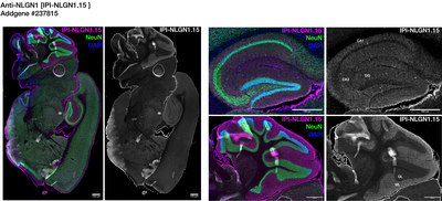 Immunohistochemistry image by Institute for Protein Innovation (IPI)