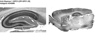 Immunohistochemistry image by James Trimmer, UC Davis