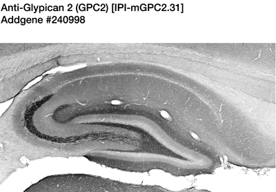 Immunohistochemistry image by UC Davis/NIH NeuroMab Facility