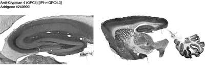 Immunohistochemistry image by James Trimmer, UC Davis