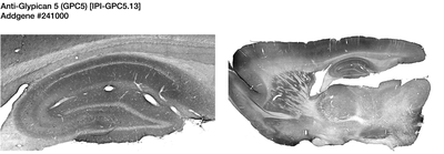 Immunohistochemistry image by James Trimmer, UC Davis