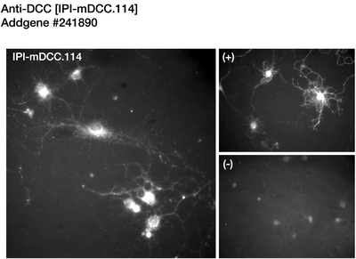 Immunocytochemistry image by Timothy Kennedy, McGill University