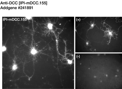 Immunocytochemistry image by Timothy Kennedy, McGill University