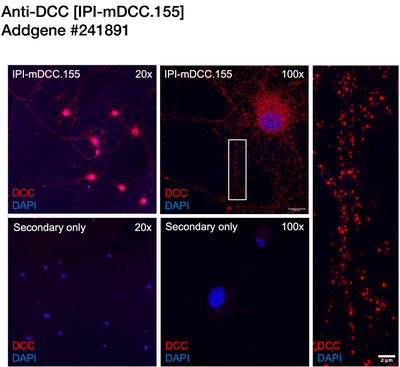 Immunocytochemistry image by Timothy Kennedy, McGill University