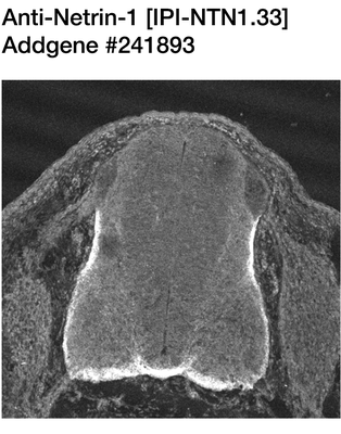Immunohistochemistry image by Samantha Butler, UCLA