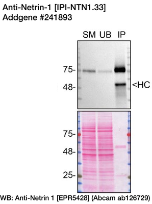 Immunoprecipitation image by Carl Laflamme, YCharOS