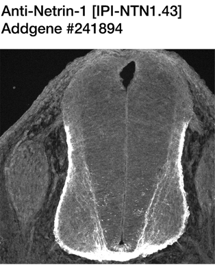 Immunohistochemistry image by Samantha Butler, UCLA