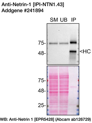 Immunoprecipitation image by Carl Laflamme, YCharOS