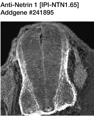Immunohistochemistry image by Samantha Butler, UCLA