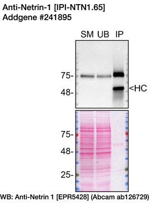 Immunoprecipitation image by Carl Laflamme, YCharOS