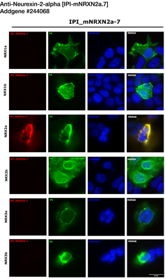 Immunocytochemistry image by Luís F. Ribeiro, PhD
