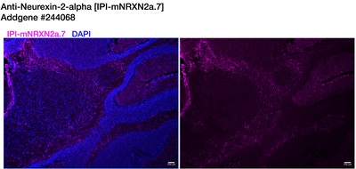 Immunohistochemistry image by Institute for Protein Innovation (IPI)