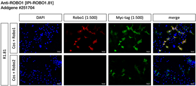 Immunocytochemistry image by Institute for Protein Innovation (IPI)