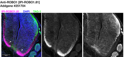 Immunohistochemistry image by Institute for Protein Innovation (IPI)