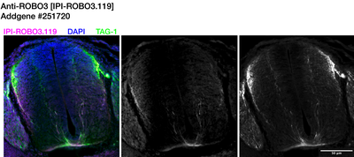 Immunohistochemistry image by Institute for Protein Innovation (IPI)