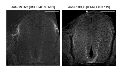 Immunohistochemistry image by Celine Santiago