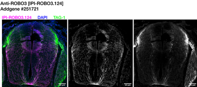 Immunohistochemistry image by Institute for Protein Innovation (IPI)