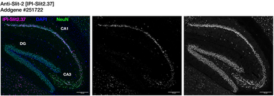 Immunohistochemistry image by Institute for Protein Innovation (IPI)
