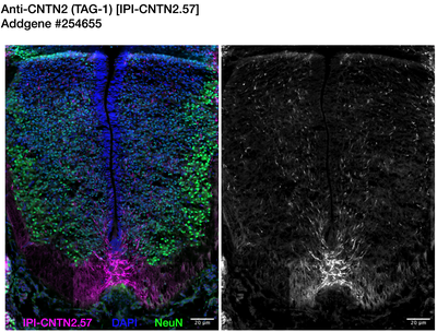 Immunohistochemistry image by Institute for Protein Innovation (IPI)