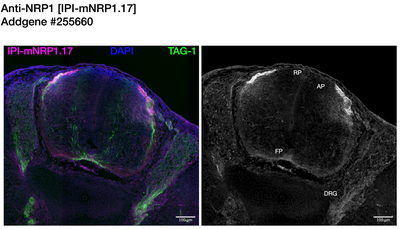 Immunohistochemistry image by Institute for Protein Innovation (IPI)