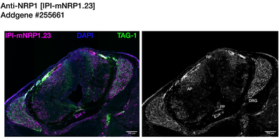 Immunohistochemistry image by Institute for Protein Innovation (IPI)