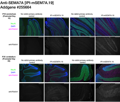 Immunohistochemistry image by Institute for Protein Innovation (IPI)