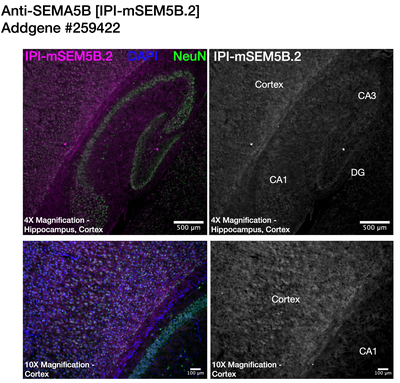 Immunohistochemistry image by Institute for Protein Innovation (IPI)