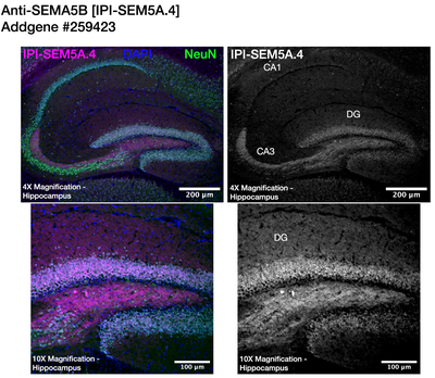 Immunohistochemistry image by Institute for Protein Innovation (IPI)