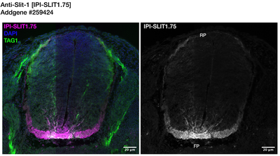 Immunohistochemistry image by Institute for Protein Innovation (IPI)