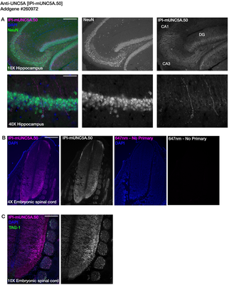 Immunohistochemistry image by Institute for Protein Innovation (IPI)